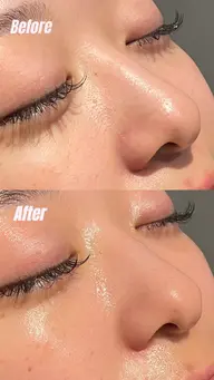 Pore care【毛穴集中】コース