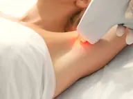 《光脱毛》vio/女性価格¥5500※ご新規様※