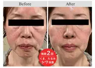 【40歳以上の方限定‼️】ビフォーアフター症例写真のご協力OKの方📷※希望日時リクエストをお願いいたします🙇♀️