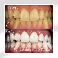 【3ヶ月通い放題¥60,000→¥50,000】ミニモ限定価格‼️この凄さわかります？回数気にせず通えるから効果最大👀