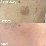 若よもぎ蒸し⭐︎集中コース