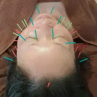 モニター特別価格📣当店人気No.1👑背中から緩めて引き上げる✨背中マッサージ+小顔リンパ&小顔リフト美容鍼+ヘッド付