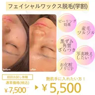 ミニモ学割🌸フェイシャル全顔ワックス✨産毛や角質ケアができピーリング効果◎お化粧ノリ・ツヤupで写真映え💖