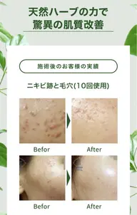 【ミニモ限定】小顔コルギ+ハーブピーリング体験70分12900——》8900口コミ必要