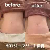 ゼロジーフリー引き締めボディ