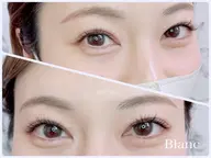 上まつ毛エクステ140本 🌷🌷💫まで付け放題🤍✨4/20 15:30～限定🤍✨