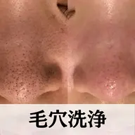 【男女/新規/花粉や皮脂対策で透明肌へ！】全顔3D毛穴洗浄　初回体験¥5500