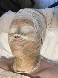 メンズスキンリノベーションコース【メンズ✴︎ミニモ 限定】ハーブピーリング剥離あり