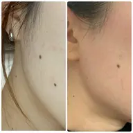 フェイシャルWax【お試し、１回目限定】