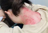 台湾式カッサ(首)