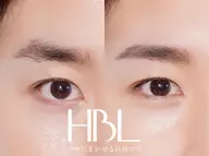 ミニモ限定⭐️新HBL