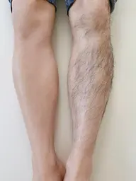 シュガーリング　脚