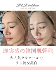 ⭐️本日限定⭐️来店の方全員にパックプレゼント❣️一回の施術でツヤ肌&美白に！話題のララピール🫧🍑