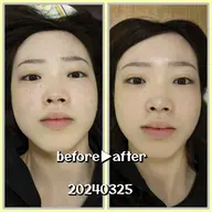 CS60フェイシャル 小顔リフトアップ