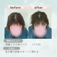 【新規限定】自然にカバー♪つむじ・分け目集中200本 通常¥8,800