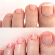 フットネイルケア(現金のみ)