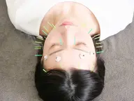 🌟minimo限定🌟小顔矯正×美容鍼 60分14300→7700