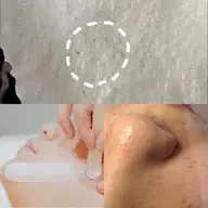 【お顔まるごと脱毛】敏感肌の方にも・産毛・毛穴レス・ツルスベ肌