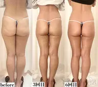 【愛されヒップ】垂れ尻改善/姿勢改善/骨盤矯正/ヒップアップ70分￥8800