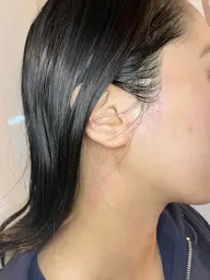 《初回》頸(うなじ)×もみあげワックス脱毛 4500円