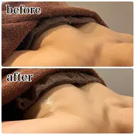 🔥期間限定🔥バストアップマッサージ＋光豊胸＋美容液導入💓👯‍♀️