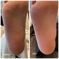 秋冬でかさついたかかとをツルツルに🦶マシーンでしっかり角質除去で赤ちゃんかかと✨