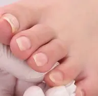 フットオフ