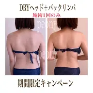 [極上の癒し]🌿超絶睡眠ヘッドスパ＋首肩凝りバックリンパ🌿