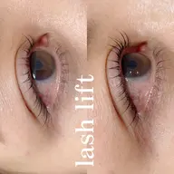 ラッシュリフト(ﾄﾘｰﾄﾒﾝﾄ付き)