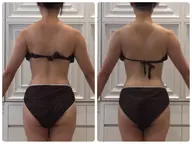 【上半身痩せ👙】キャビ＋ラジオ波＋マッサージ60分✨で気になる脂肪撃退✨