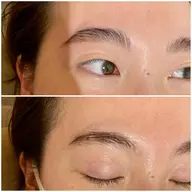 【モニター価格】すぐ予約限定🌈 HBL ハリウッドブロウリフト お顔脱毛サービス