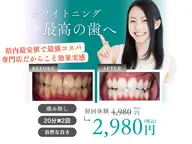 【冬のキャンペーン♪月先着制5名様残り1名様】セルフホワイトニング20分✖️2回セット