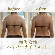 ハイパーナイフ 上半身or下半身