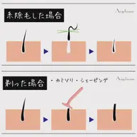 感動レベル🎉【お肌つるつる糸で顔脱毛* エイジングケアコース】うぶ毛✨ひげ✨ボサボサ眉毛✨化粧ノリアップ‼️