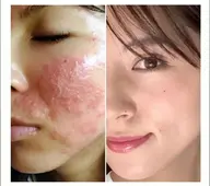 【全員】最先端肌質改善マシンを使ってあらゆるお悩みに合わせて肌をベストな状態に✨