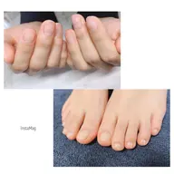 ハンドケア&フットケア★Wケアコース★