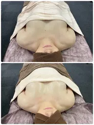 【20代女子専用】ゆるふわバストを作るボリュームアップエステ◇夏の水着やVネックが似合うボディへ！