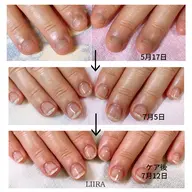 育爪‼️小さい爪、噛み癖、いじり癖、肌荒れなど肌や爪の悩み解決いたします✨理想の爪になれます＾＾