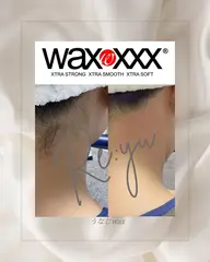 うなじwax脱毛