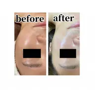 《美白ツヤ肌コース》