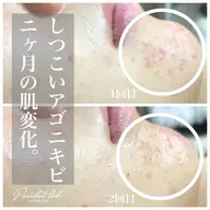 【初回限定価格✨】迷ったらコレ!/繰り返す肌荒れ/肩首コリ/敏感肌/むくみ/肌ｽﾄﾚｽ撃退フェイスリペルコース60min