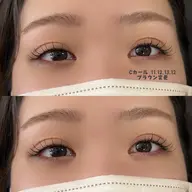 フラットラッシュ100本