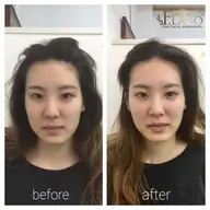 【たるみケア】本気の肌改善を目指す方へ（90分）