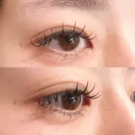 フラットラッシュ100本