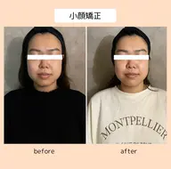 【小顔/リフトアップ/エラの張り/左右差/目の疲れ/たるみ】痛みのない💆‍♀️矯正美顔マッサージ