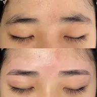 アイブロウワックス脱毛