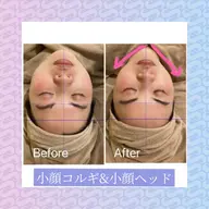 小顔フェイシャル（毛穴洗浄＆美白ケア）