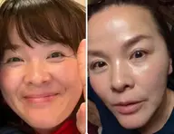 韓国から入ってきたばかりの最新技術を使った水光肌をつくるピカピカフェイシャルエステ　50 60 70代限定