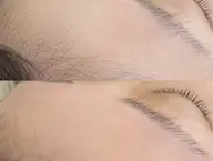 🉐30%オフ💫フルフェイスWAX脱毛＋美眉スタイリング（眉メイク込)🪞骨格診断📍渋谷駅3分🐾神南【口コミ投稿】