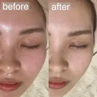 🫧minimo価格🫧 【毛穴ケア/くすみケア/保湿】感動の毛穴レス・トーンUP✨フェイシャルエステ